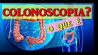 🔴COLONOSCOPIA  COMO É FEITO O EXAME E PARA QUE SERVE [upl. by Gustave]