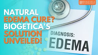 Can Natural Edema Treatment of cure Edema [upl. by Stavros133]