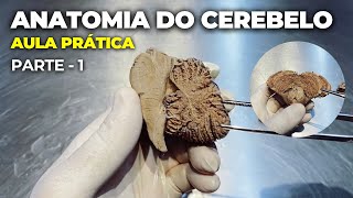 ANATOMIA DAS VIAS ASCENDENTES DA MEDULA ESPINAL  AFERENTES  SOMATOSSENSORIAIS E CEREBELARES 12 [upl. by Naryb90]