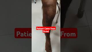 3 Months Post Op ACL Reconstruction Surgery Patient Testimonial Pt Came From DubaiDr Sai Chandra [upl. by Nagyam]