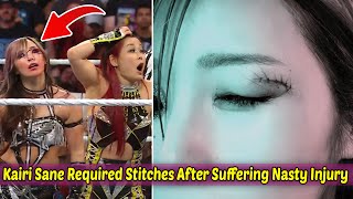 Kairi Sane Required Stitches After Suffering Nasty Injury During WWE RAW [upl. by Oza]