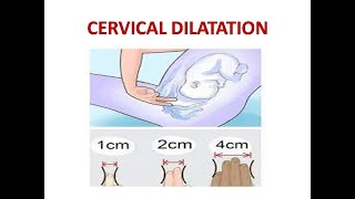 CERVICAL DILATATION [upl. by Sarchet]