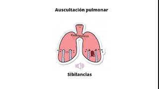 Ruidos respiratorios agregados  Sibilancias [upl. by Eliason869]