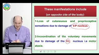 Thalamic syndrome [upl. by Eelimaj744]