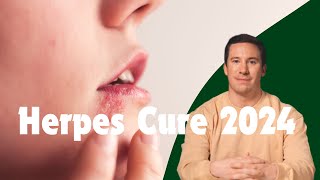 Herpes Simplex Virus Type 1 Cure amp Treatment 2024  The Elementary Info [upl. by Ennairak]