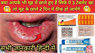 सिर्फ ये टेबलेट खा लो मुह के छाले 1 दिन मेें ठीक हो जायेंगे  Stomatitis Treatment in hindi  Ulcer [upl. by Howlan]