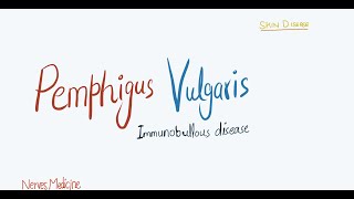 Pemphigus Vulgaris  clinical features pathophysiology and histology  immunobullous skin disease [upl. by Croix]