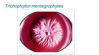 Superficial Fungal Infections Dermatophytes Part 2 Hot Topic [upl. by Elokyn]