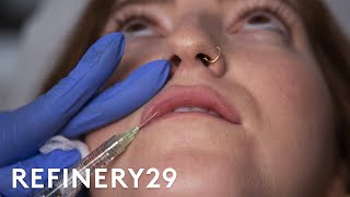 I Got Lip Filler Injections For The First Time  Macro Beauty  Refinery29 [upl. by Pan]