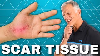 How to Get Rid of Scar Tissue After Surgery or Injury Hardened [upl. by Lennox]