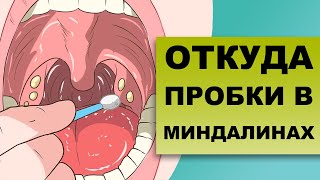 КАК УХОДЯТ ПРОБКИ ИЗ МИНДАЛИН [upl. by Selia]