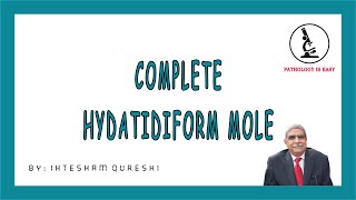 Complete Hydatidiform Mole Female Genital Tract [upl. by Ariahaj]