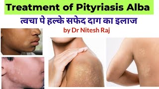 सफेद दाग का इलाजPityriasis Alba treatment in hindi drniteshraj [upl. by Hayotal996]