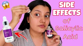 SIDE EFFECTS of Salicylic Acid  Is Salicylic Acid Safe To Use For ACNE amp PIMPLES [upl. by Scevo842]