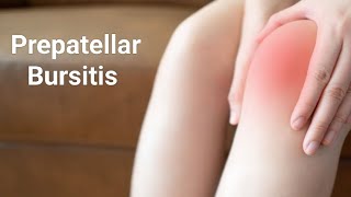 Prepatellar Bursitis Housemaids Knee Rehab Exercises [upl. by Bobinette]