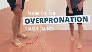 Pronated Feet and How to Fix 3 Different Causes of OVERPRONATION [upl. by Camus102]