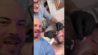 This is an EPIC cyst pop on the cheek 😵‍💫 trending skincare viralvideo [upl. by Skippie]