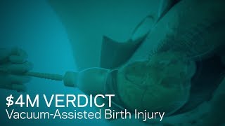 4M Verdict Animating VacuumAssisted Birth Injury [upl. by Azile]