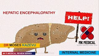 Hepatic encephalopathy [upl. by Anirrok]