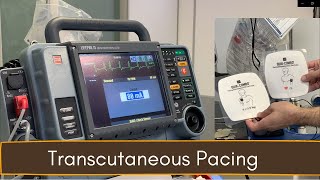 Crash Cart 04 Transcutaneous Pacing TCP [upl. by Barbee]