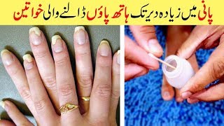 Get Rid of Toenails Fungus Natural Treatment amp Cure Simple Home Remedies Urdu Hindi [upl. by Noleta914]