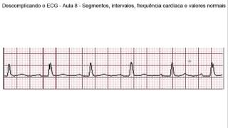 Descomplicando o ECG  Aula 8  Segmentos intervalos frequência cardíaca e valores normais [upl. by Yrad]