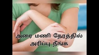 அரை மணி நேரத்தில் அரிப்பு நீங்க  home remedy for Itching in tamil skin problemnatural remedie [upl. by Drofdeb]