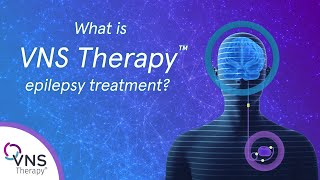 What is VNS Therapy Epilepsy Treatment [upl. by Giuliana475]