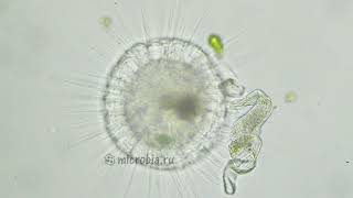 Heliozoan grabs a ciliate Солнечник пожирает инфузорию [upl. by Attolrac81]