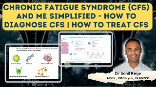 Chronic Fatigue Syndrome and ME Simplified  How to Diagnose and Treat CFS  A Psychiatrist Explains [upl. by Annas112]