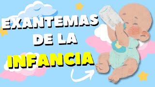 Exantemas de la Infancia ¡FÁCIL Y RÁPIDO [upl. by Nagard185]