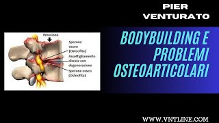 bodybuilding e problemi osteoarticolari sciatica cervicale e altro [upl. by Lubin]