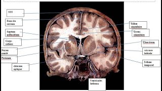 Anatomie topographique du cerveau  coupes frontales sériées [upl. by Frederik631]