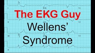 Wellens Syndrome  EKGECG Course 1200  The EKG Guy  wwwekgmd [upl. by Sel]