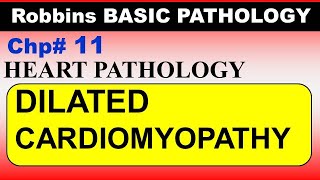 Chp11 Robbins Patho  Heart Pathology  DILATED Cardiomyopathy  Dr Asif Lectures [upl. by Icats509]