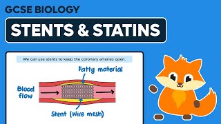 Stents amp Statins  GCSE Biology [upl. by Zebe679]