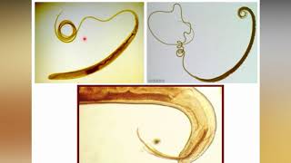 8Lecture of Vet Nematodes Oxyuis  Trichuris and Trichinella [upl. by Annayr]