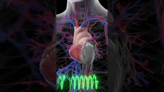 Watch as a Heart Attack unfolds anatomy heartattack [upl. by Dani]