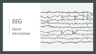 Was ist ein EEG  einfache kurze Erklärung Elektroenzephalografie [upl. by Drofliw434]