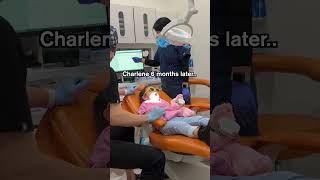 Highly observant child remembers instructions TOO well 😂 Pediatric Dentist [upl. by Bobbee]