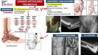 Fracturas Lesiones de Partes Blandas  Ortopedia y Traumatología Clases Qx Medic  04 [upl. by Sells]