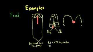 Schneid Guide to Neurological Lesion Localization [upl. by Elyr591]