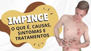 Impinge  o que é causas sintomas e tratamentos [upl. by Darcey121]