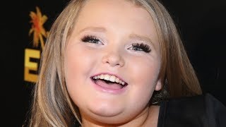 Why Were Worried About Honey Boo Boo [upl. by Yeslek59]