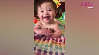 Baby with Down syndrome cant stop smiling [upl. by Melc994]