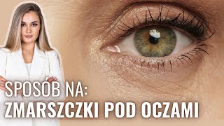 ❤️NAJLEPSZE SPOSOBY NA ZMARSZCZKI POD OCZAMI  DIETA ZABIEGI SEN PIELĘGNACJA I WIELE INNYCH [upl. by Yekciv]