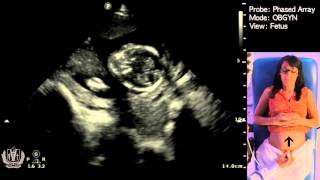 Obstetric Ultrasound Basics with Fetal Heart Rate Calculation​  Made Simple [upl. by Trilbie]