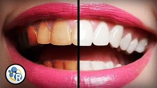 Whats The Best Way To Whiten Teeth [upl. by Euell846]