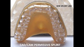 CADCAM Permissive Splint by MIK Dental Lab TMJ TMD [upl. by Tail]