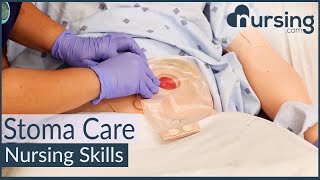 Stoma Care Changing a Colostomy Bag Nursing Skills [upl. by Ahsikyt]